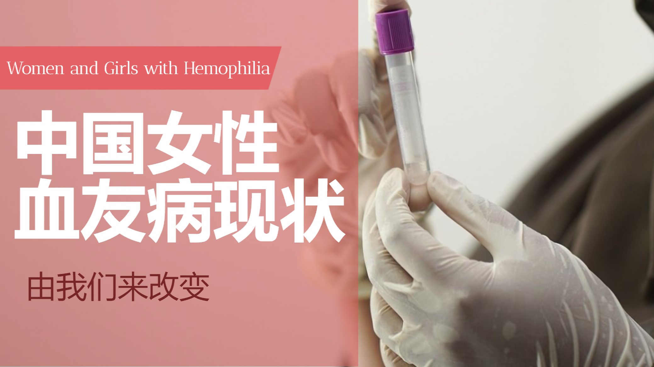 活动照片5